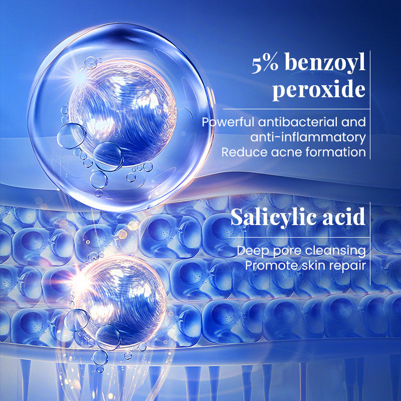 KÒRMESIC 5% Benzoyl Peroxide Acne Care Kit, photo 4